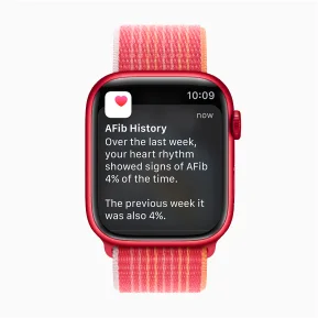 Apple watch7:25
